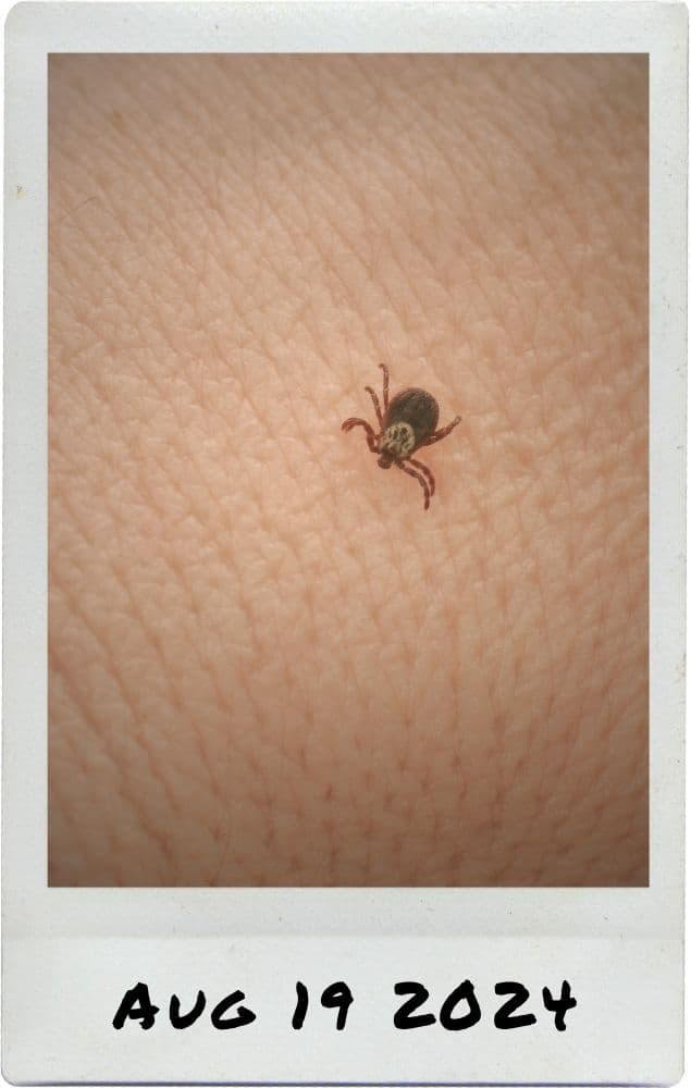 Tick in my Leg